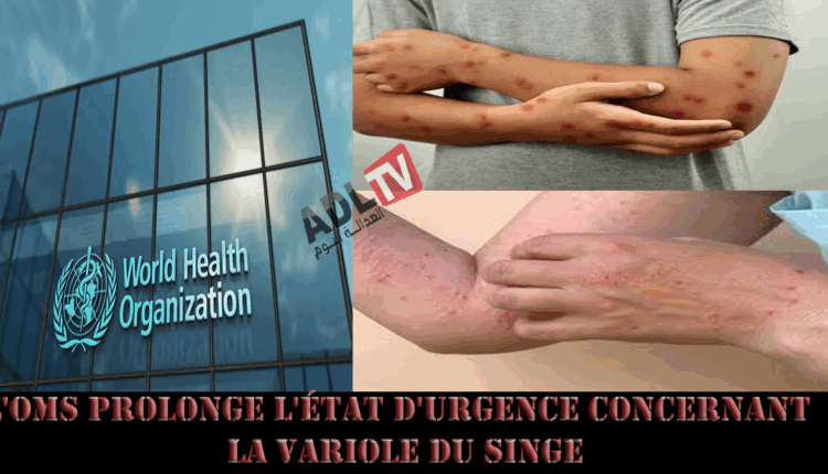 #الصحة العالمية تمدد حالة الطوارئ ذات الصلة بفيروس "جدري القردة"