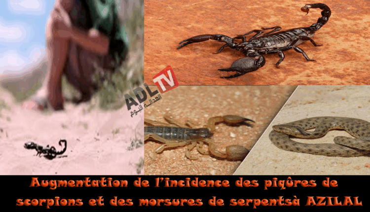 #ارتفاع أرقام لسعات العقارب ولذغات الأفاعي بإقليم "ازيلال" بالمغرب